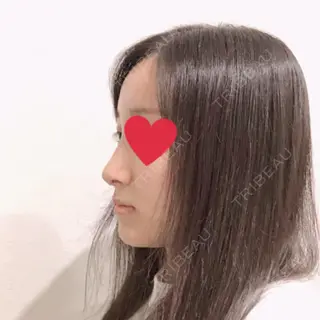 8日目の経過画像（3枚目）