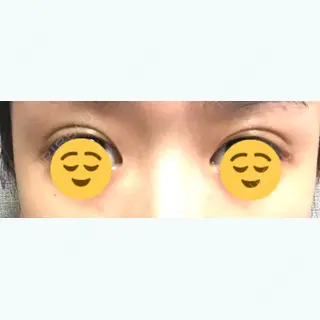 2日目の経過画像（2枚目）