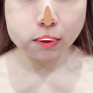 1日目の経過画像（1枚目）