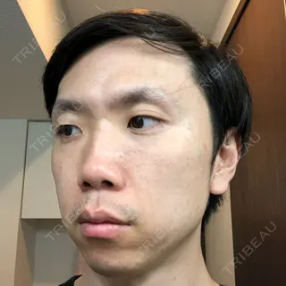 1日目の経過画像（1枚目）