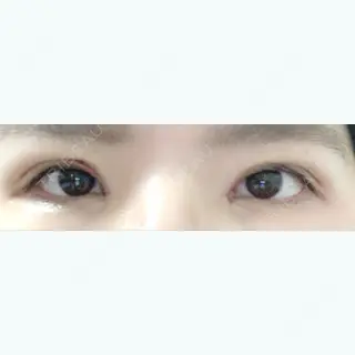 3日目の経過画像（1枚目）