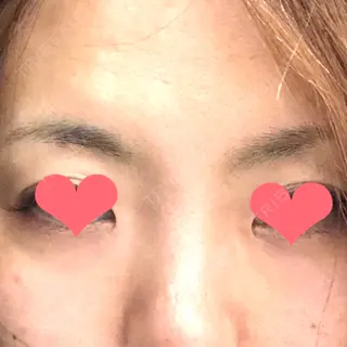0日目の経過画像（1枚目）