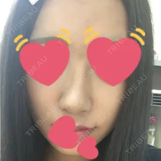 7日目の経過画像（1枚目）