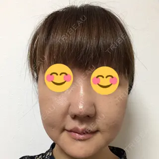 16日目の経過画像（1枚目）