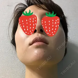 0日目の経過画像（2枚目）