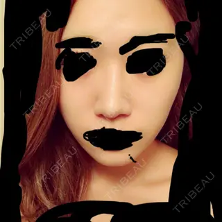 37日目の経過画像（2枚目）