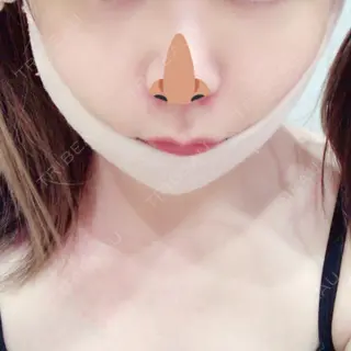 6日目の経過画像（1枚目）