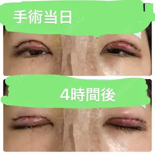 0日目の経過画像（1枚目）