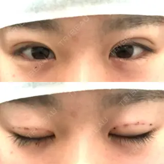 1日目の経過画像（1枚目）