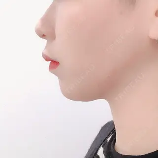 205日目の経過画像（3枚目）