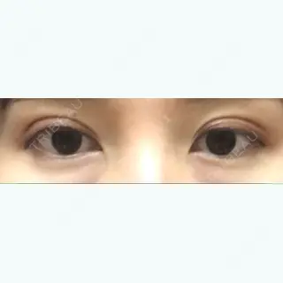 23日目の経過画像（1枚目）