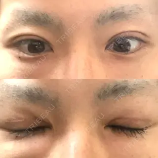 22日目の経過画像（1枚目）