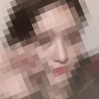 166日目の経過画像（2枚目）