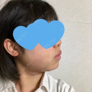 2日目の経過画像（2枚目）
