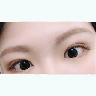 19日目の経過画像（1枚目）