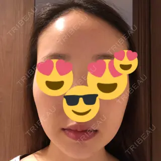 0日目の経過画像（3枚目）