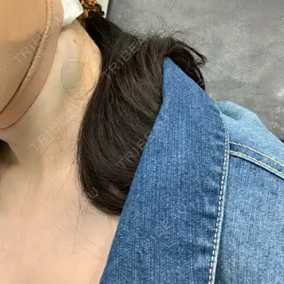 0日目の経過画像（3枚目）
