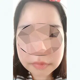 23日目の経過画像（1枚目）