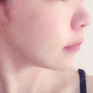 10日目の経過画像（2枚目）