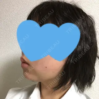 4日目の経過画像（3枚目）