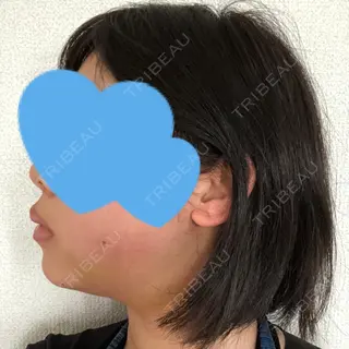 5日目の経過画像（3枚目）
