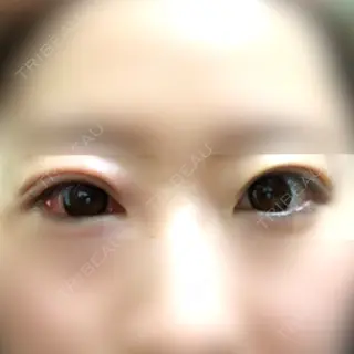 20日目の経過画像（1枚目）