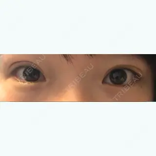 22日目の経過画像（2枚目）