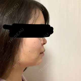 1日目の経過画像（2枚目）