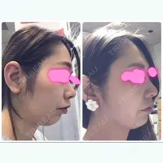 280日目の経過画像（1枚目）