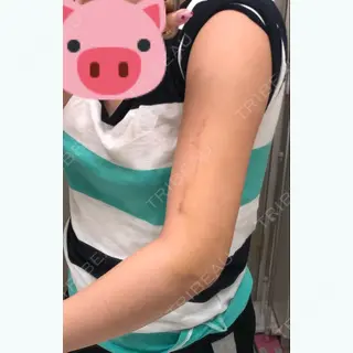 9日目の経過画像（2枚目）