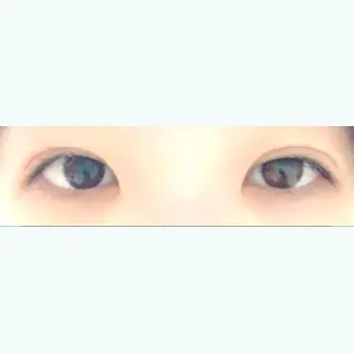 20日目の経過画像（1枚目）