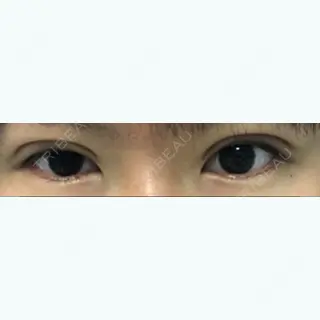 24日目の経過画像（1枚目）