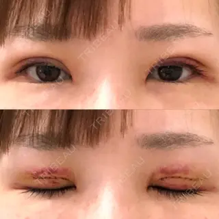 2日目の経過画像（1枚目）