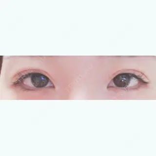 48日目の経過画像（1枚目）