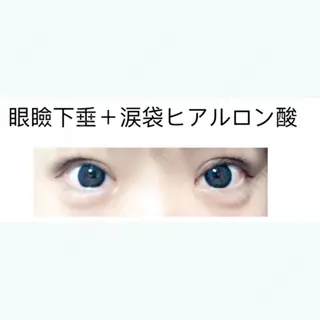 14日目の経過画像（1枚目）