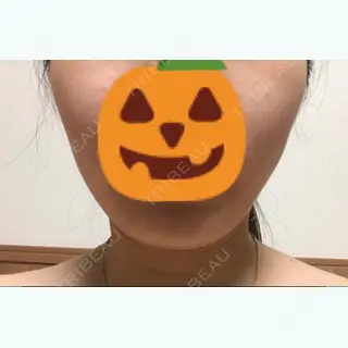 11日目の経過画像（1枚目）
