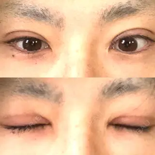 28日目の経過画像（1枚目）