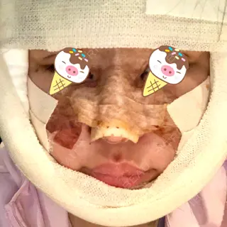 2日目の経過画像（1枚目）