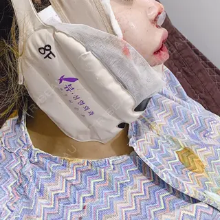 0日目の経過画像（1枚目）