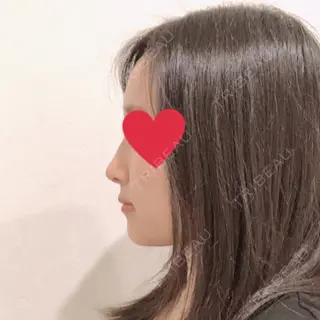 12日目の経過画像（2枚目）