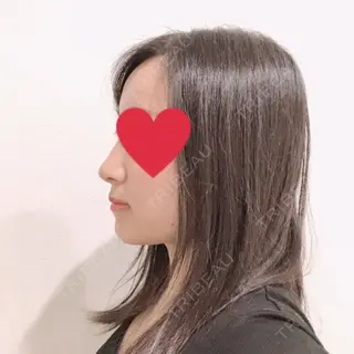 12日目の経過画像（3枚目）