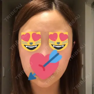 2日目の経過画像（1枚目）