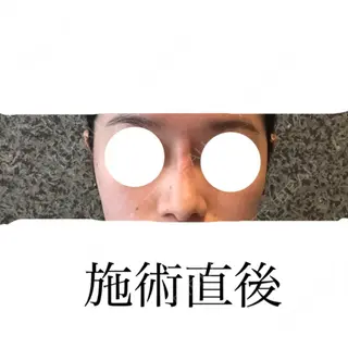 0日目の経過画像（3枚目）