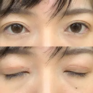 21日目の経過画像（1枚目）