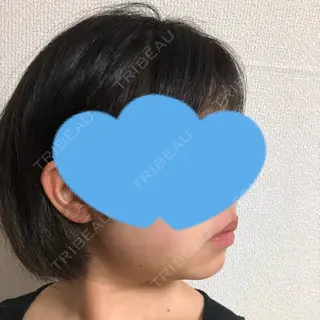 10日目の経過画像（2枚目）