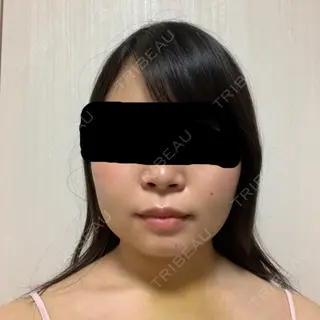 6日目の経過画像（1枚目）