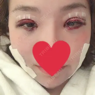 1日目の経過画像（1枚目）