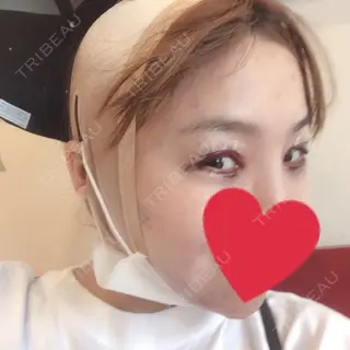 2日目の経過画像（3枚目）