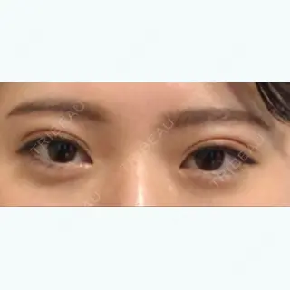 10日目の経過画像（1枚目）