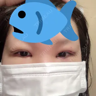 3日目の経過画像（1枚目）